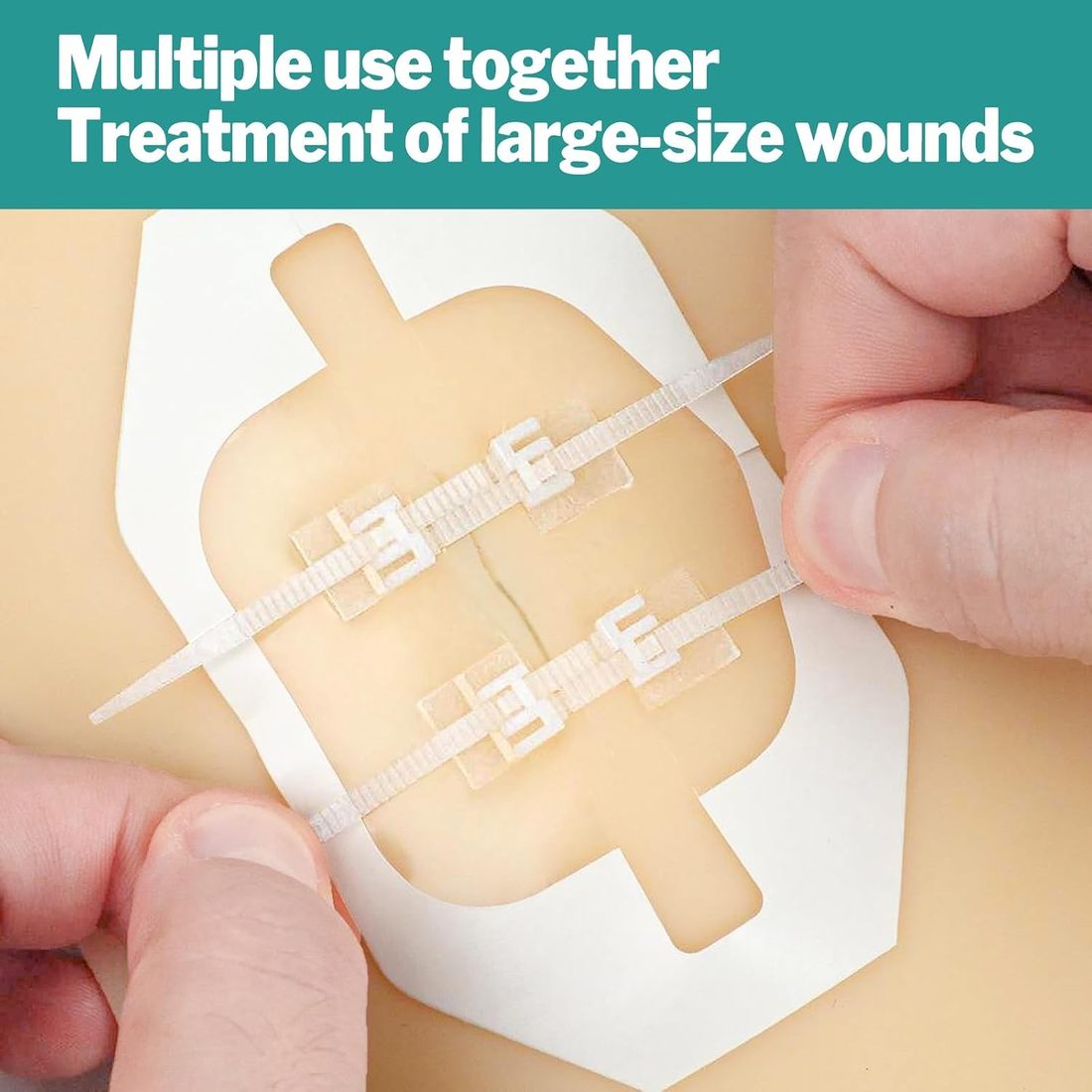 AZEN Zip-Stitch Wound Closure Devices, 10 Count, view 4