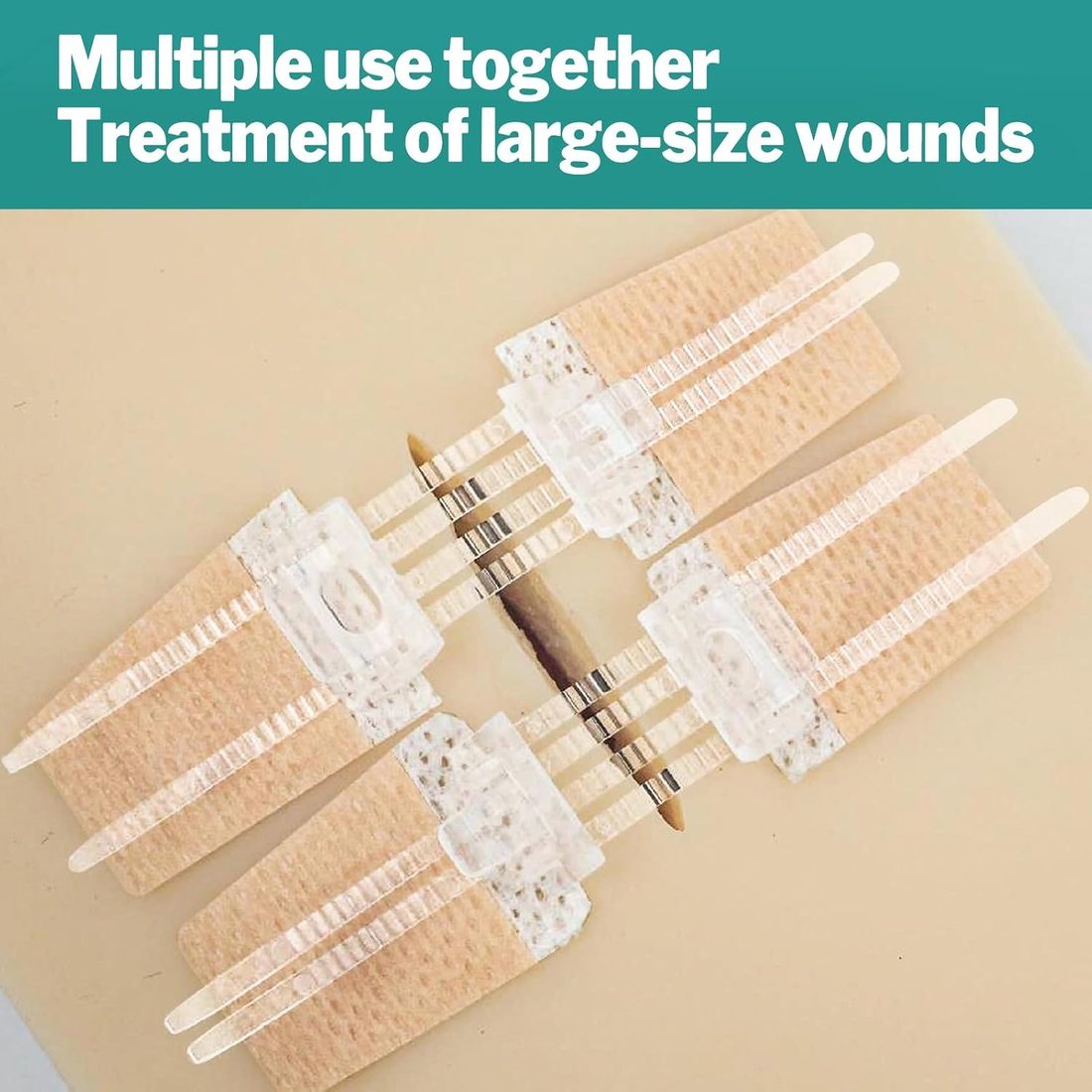 AZEN Zip-Style Wound Closure Strips · 10 Pack, view 4